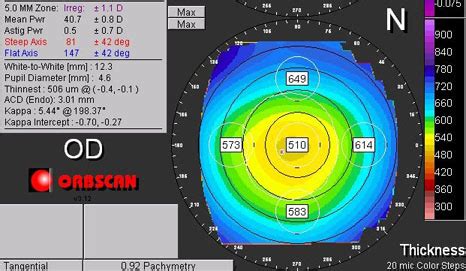 thick cornea measurement a 6|cornea thickness for lasik.